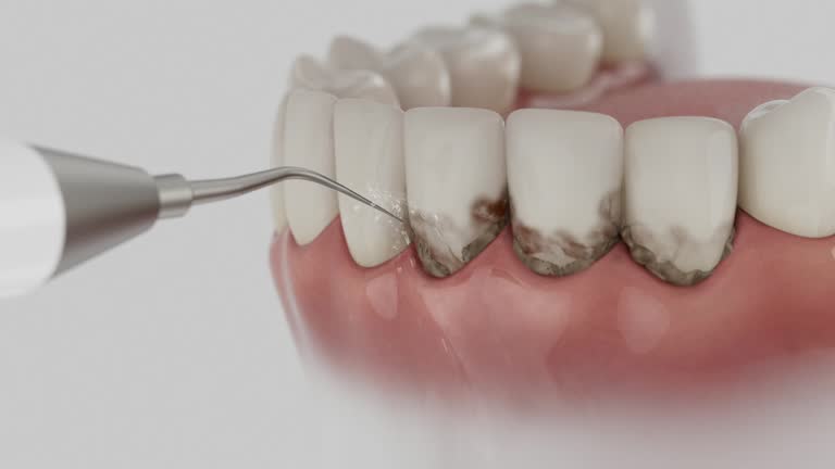 Reliable Dental Implants contractor in Midland, TX by Smile Center Dentistry